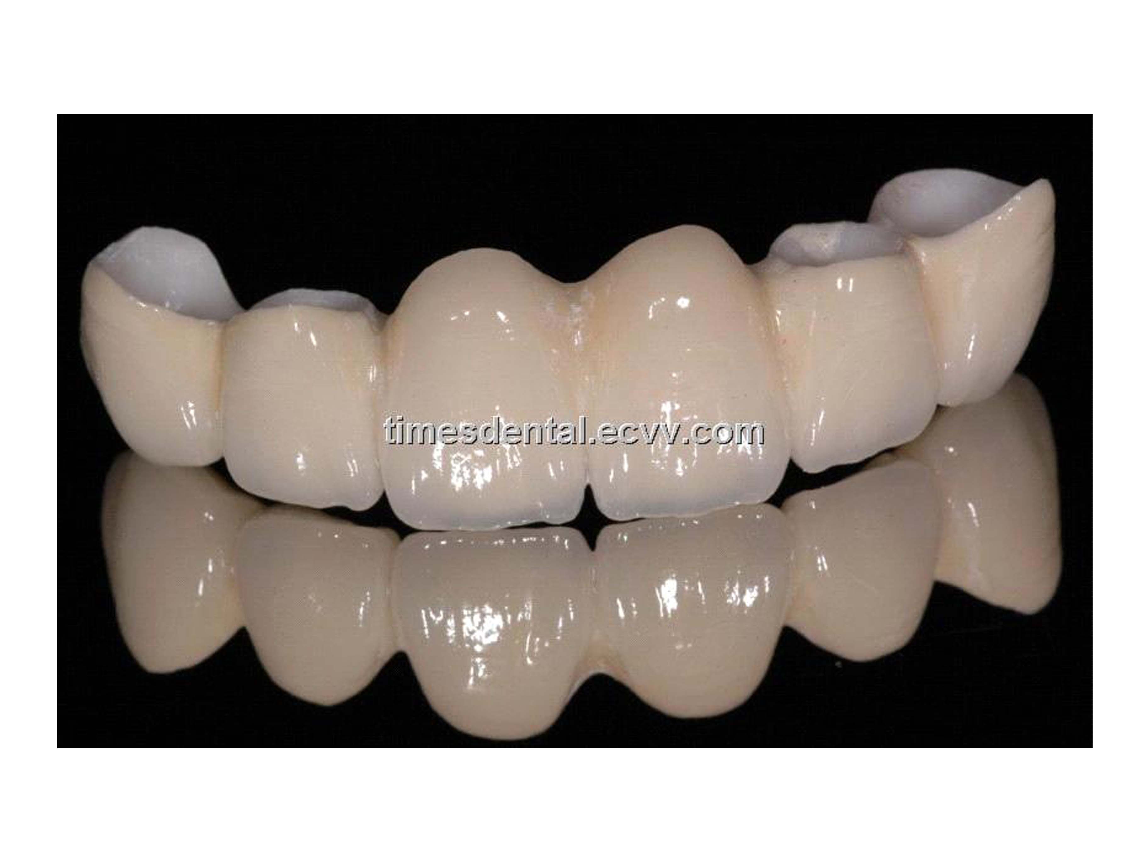 Dental Crowns and Bridges in Secunderabad