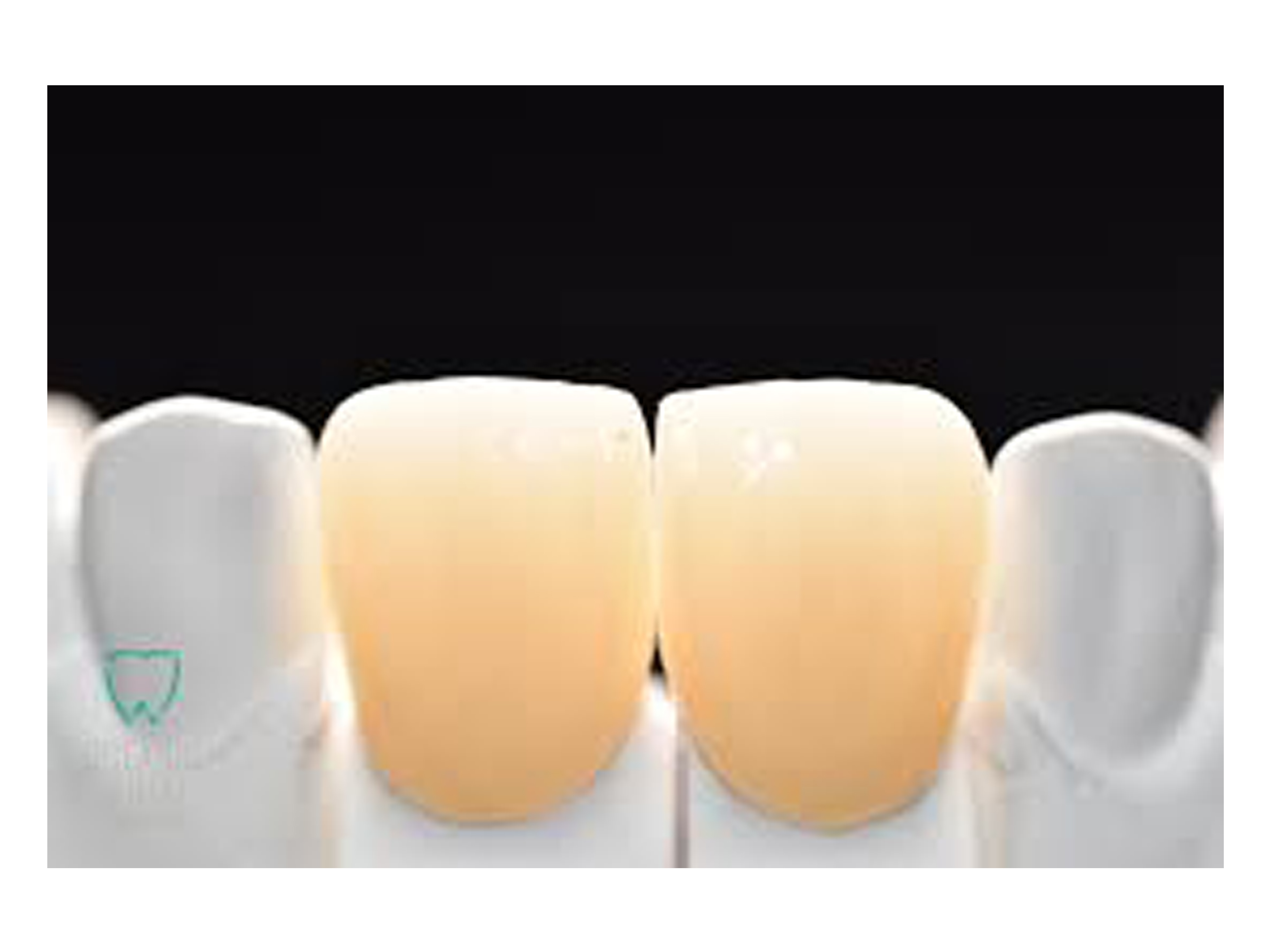 Dental Crowns and Bridges in Secunderabad